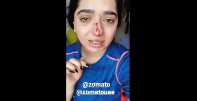 बेंगलूरु: ज़ोमैटो डिलीवरी बॉय से झड़प में नाक की हड्डी टूटने से महिला घायल